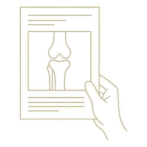 Ilustração do plano intervencionista personalizado